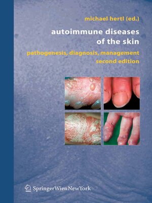 cover image of Autoimmune Diseases of the Skin